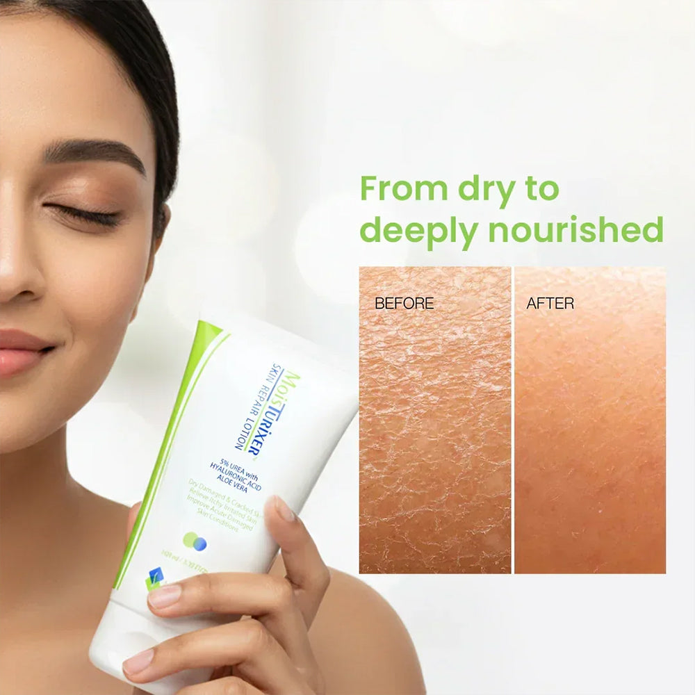 MOISTURIXER 5%