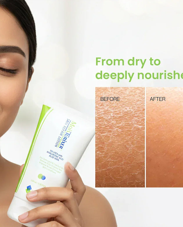 MOISTURIXER 5%