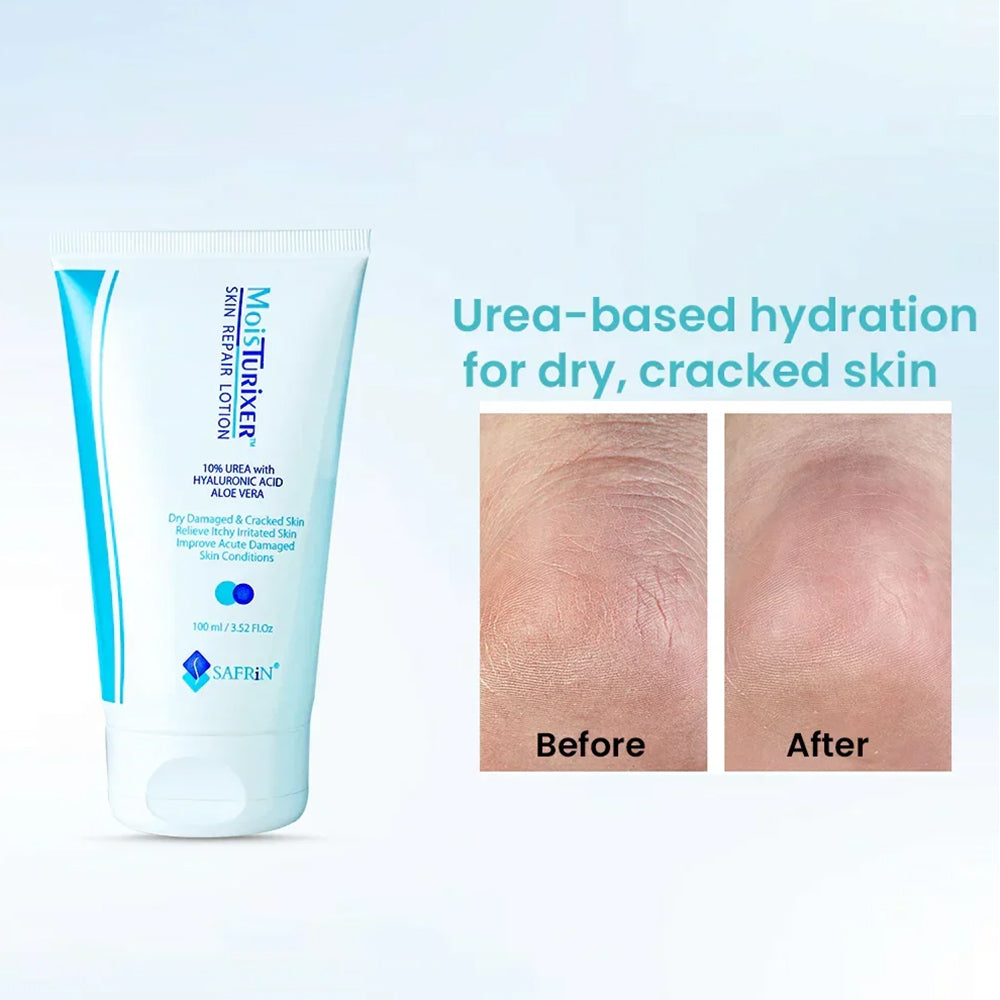MOISTURIXER 10%